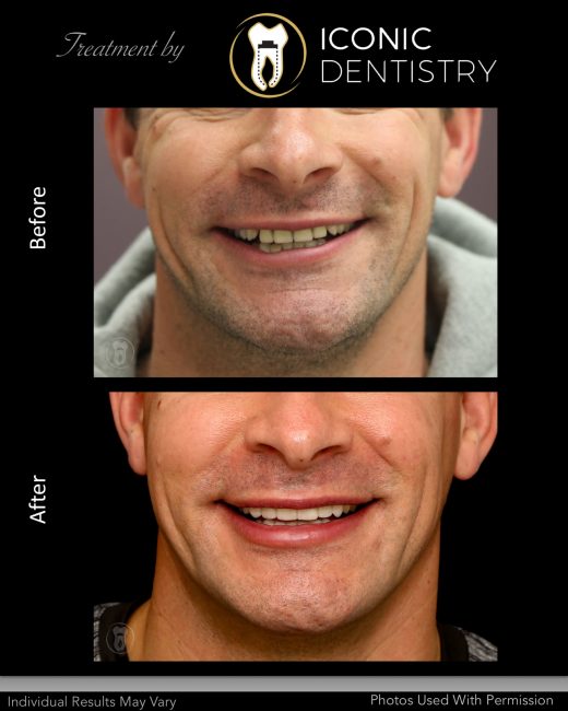 Iconic Dentistry Smile Gallery   Slide15 520x650 