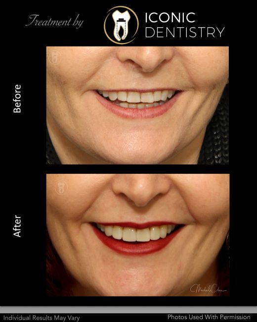 Iconic Dentistry Smile Gallery   Slide25 520x650 